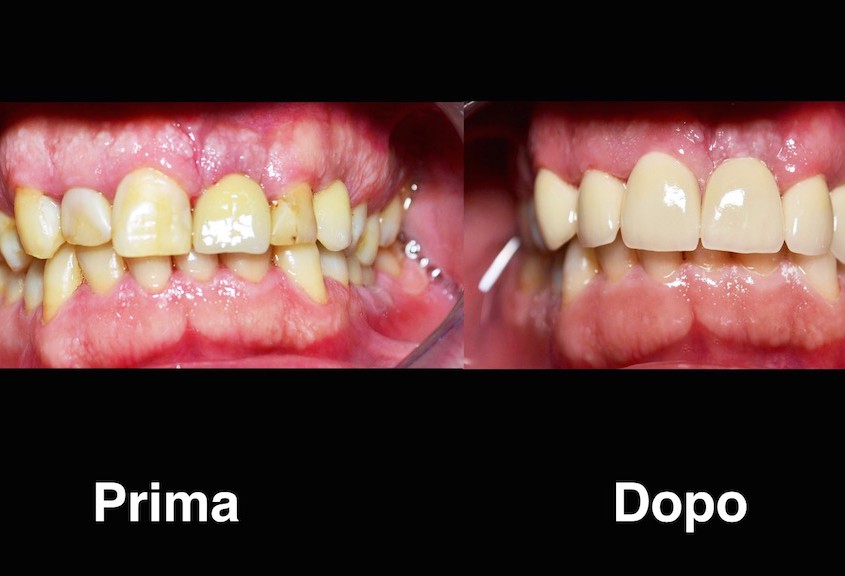 dentisti moldavia dentisti-moldavia