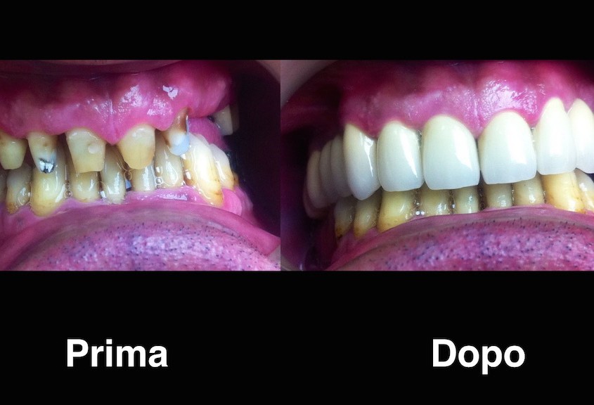 dentisti moldavia dentisti-moldavia