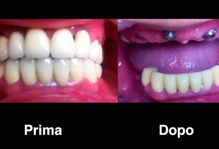 dentisti moldavia dentisti-moldavia