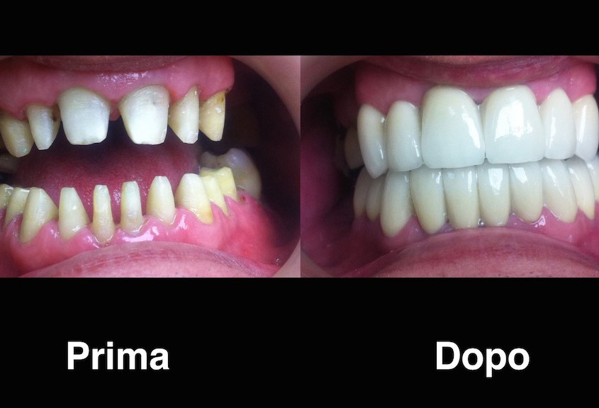 dentisti moldavia dentisti-moldavia