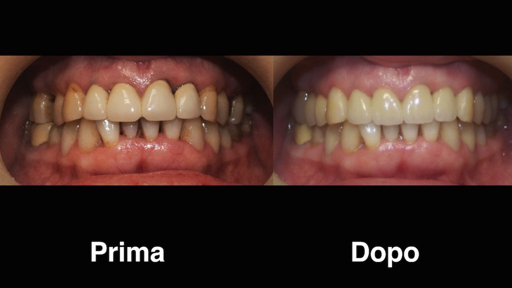 dentisti moldavia dentisti-moldavia