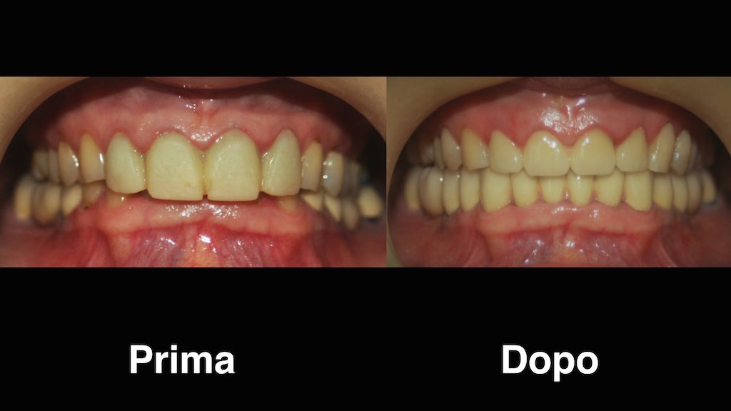dentisti moldavia dentisti-moldavia
