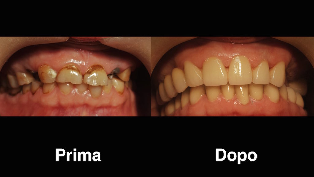 dentisti moldavia dentisti-moldavia