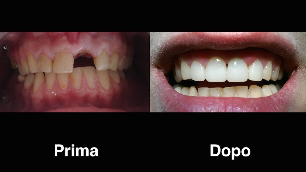 dentisti-moldavia