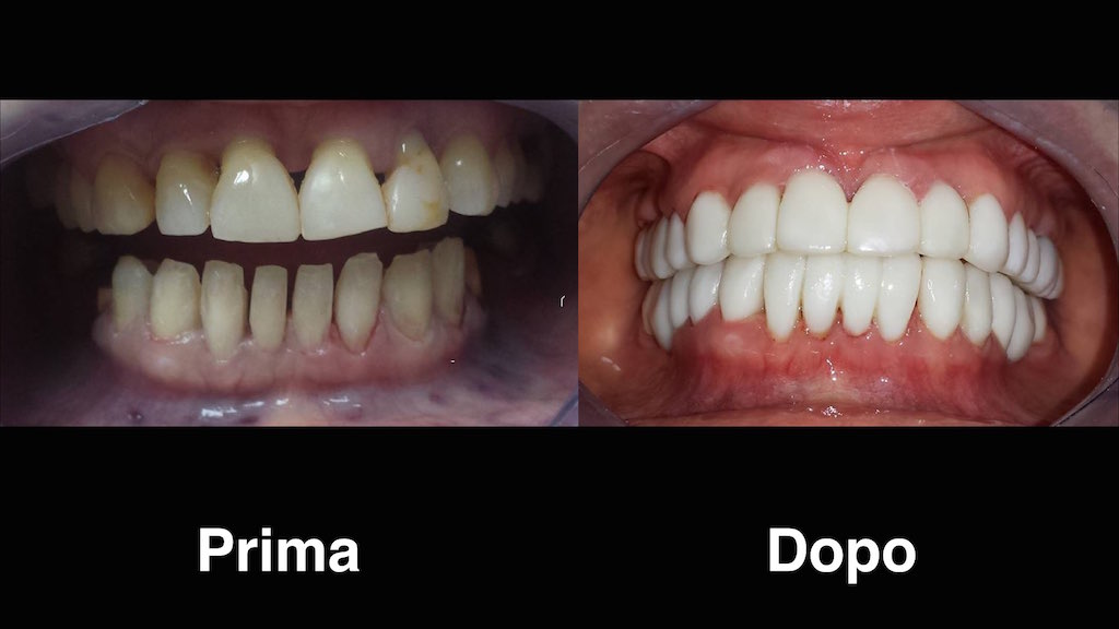 dentisti moldavia dentisti-moldavia
