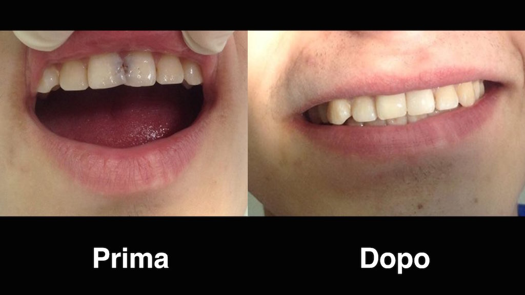 dentisti moldavia dentisti-moldavia