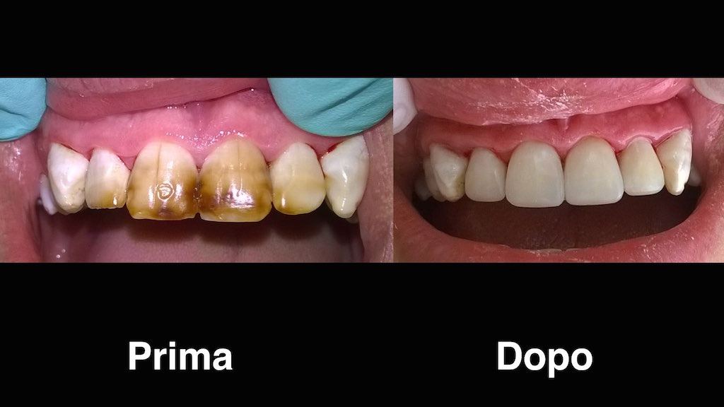dentisti moldavia dentisti-moldavia