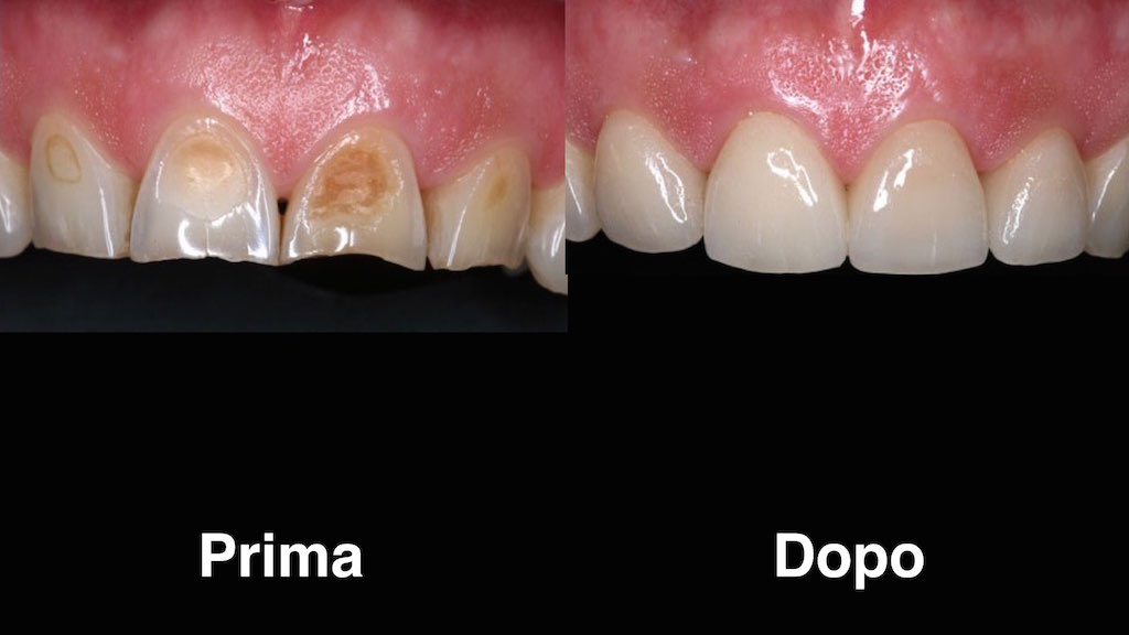 dentisti moldavia dentisti-moldavia