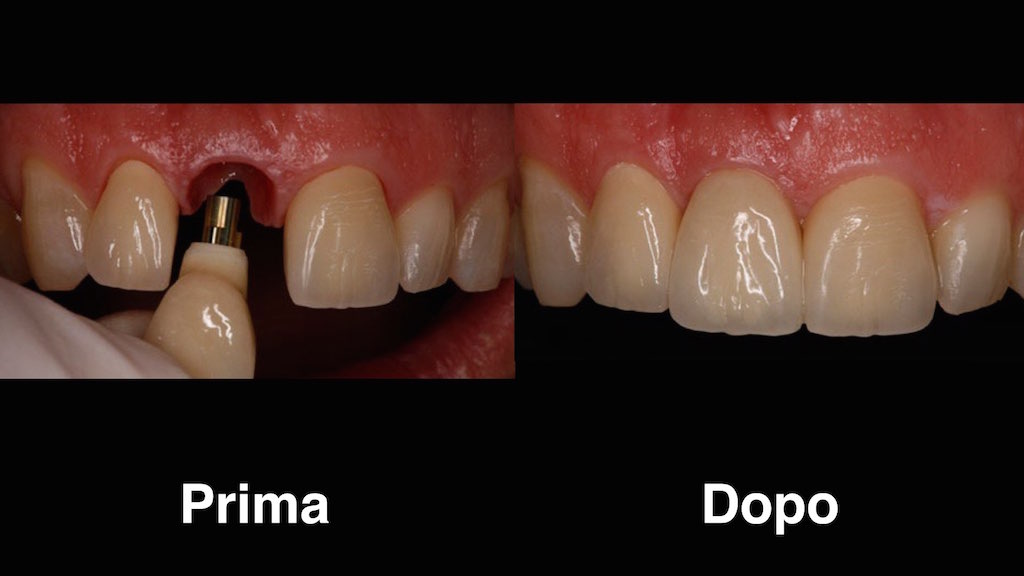 dentisti moldavia dentisti-moldavia