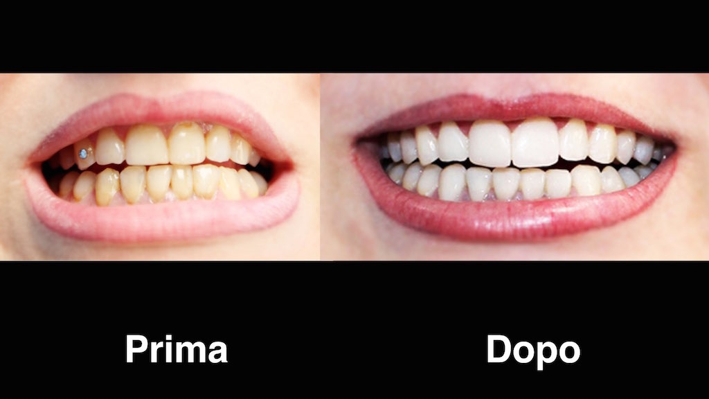 dentisti moldavia dentisti-moldavia