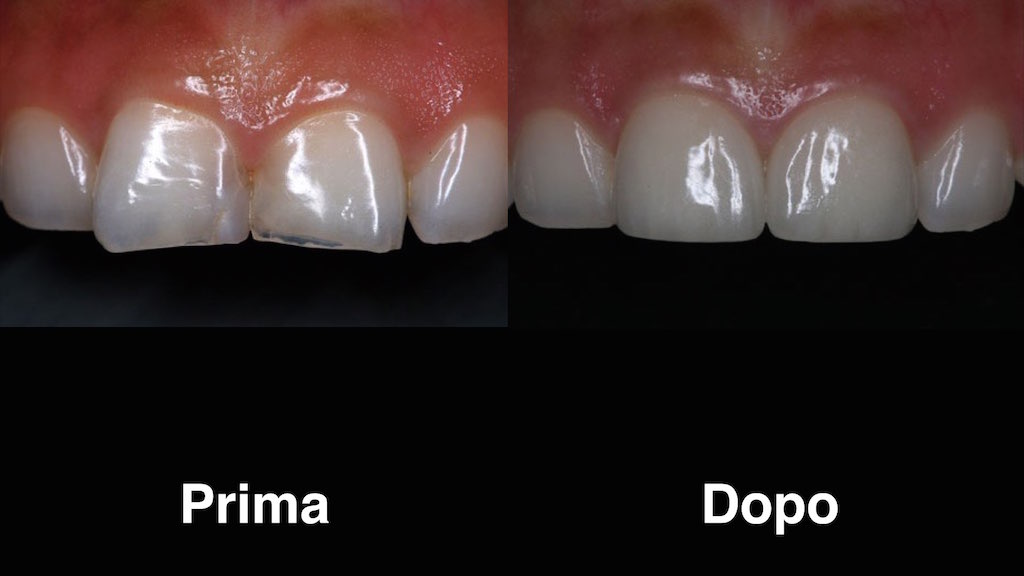 dentisti moldavia dentisti-moldavia