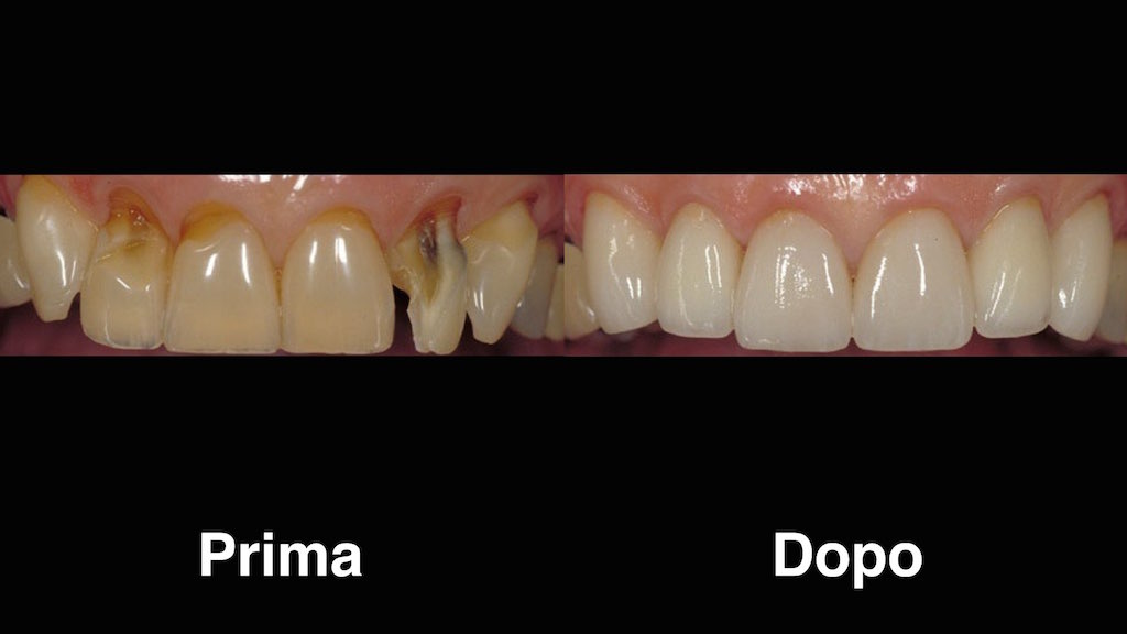 dentisti moldavia dentisti-moldavia
