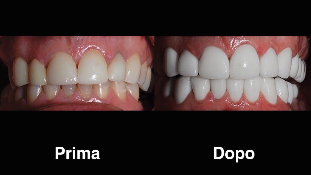 dentisti moldavia dentisti-moldavia